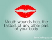 Why Mouth Wounds Heal Faster Than Elsewhere